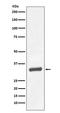 Kallikrein Related Peptidase 3 antibody, M01505-1, Boster Biological Technology, Western Blot image 