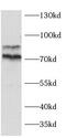 Metadherin antibody, FNab10423, FineTest, Western Blot image 