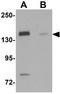 NEDD4 Binding Protein 1 antibody, GTX31425, GeneTex, Western Blot image 