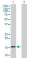 ARP antibody, H00007873-B01P, Novus Biologicals, Western Blot image 