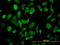 Nuclear Receptor Coactivator 4 antibody, LS-C133534, Lifespan Biosciences, Immunofluorescence image 