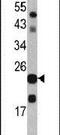 Transgelin antibody, PA5-13633, Invitrogen Antibodies, Western Blot image 