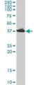 Adenosine Deaminase antibody, H00000100-M01, Novus Biologicals, Western Blot image 