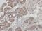 RAB2A, Member RAS Oncogene Family antibody, NBP1-31480, Novus Biologicals, Immunohistochemistry paraffin image 