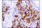 Cadherin 1 antibody, 14472S, Cell Signaling Technology, Immunohistochemistry paraffin image 