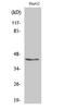 Potassium Voltage-Gated Channel Subfamily A Regulatory Beta Subunit 3 antibody, A14634, Boster Biological Technology, Western Blot image 