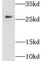 Glutathione S-Transferase Mu 5 antibody, FNab03695, FineTest, Western Blot image 