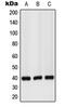 G Protein-Coupled Receptor 160 antibody, MBS821360, MyBioSource, Western Blot image 