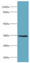 Lymphatic Vessel Endothelial Hyaluronan Receptor 1 antibody, LS-C380434, Lifespan Biosciences, Western Blot image 