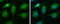 Branched Chain Keto Acid Dehydrogenase E1 Subunit Alpha antibody, GTX111382, GeneTex, Immunocytochemistry image 