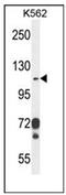 Integrin Subunit Alpha E antibody, AP52253PU-N, Origene, Western Blot image 