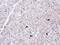 Scavenger Receptor Class A Member 3 antibody, NBP1-32130, Novus Biologicals, Immunohistochemistry paraffin image 