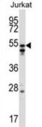 Heterogeneous Nuclear Ribonucleoprotein H2 antibody, abx027426, Abbexa, Western Blot image 