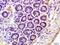 Killer Cell Immunoglobulin Like Receptor, Two Ig Domains And Long Cytoplasmic Tail 3 antibody, orb5811, Biorbyt, Immunohistochemistry paraffin image 