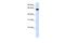 Heparan Sulfate 6-O-Sulfotransferase 3 antibody, A14382, Boster Biological Technology, Western Blot image 