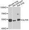 Glucagon Like Peptide 1 Receptor antibody, A8547, ABclonal Technology, Western Blot image 