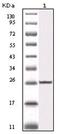 Inhibitor Of Nuclear Factor Kappa B Kinase Subunit Beta antibody, AM06155SU-N, Origene, Western Blot image 