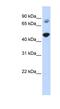 TBC1 Domain Family Member 16 antibody, NBP1-55489, Novus Biologicals, Western Blot image 