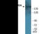 RNA Polymerase II Subunit A antibody, EKC1996, Boster Biological Technology, Western Blot image 