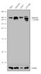 SPG11 Vesicle Trafficking Associated, Spatacsin antibody, 702776, Invitrogen Antibodies, Western Blot image 