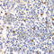 Proteasome 26S Subunit, Non-ATPase 7 antibody, A5356, ABclonal Technology, Immunohistochemistry paraffin image 