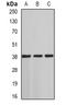 ST3 Beta-Galactoside Alpha-2,3-Sialyltransferase 4 antibody, orb341035, Biorbyt, Western Blot image 