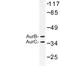 Aurora Kinase B antibody, LS-C176676, Lifespan Biosciences, Western Blot image 