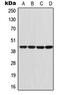 G Protein Subunit Alpha I1 antibody, MBS822100, MyBioSource, Western Blot image 