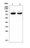 DEAD-Box Helicase 4 antibody, A02448, Boster Biological Technology, Western Blot image 
