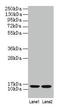 Beta-2-Microglobulin antibody, LS-C285458, Lifespan Biosciences, Western Blot image 