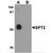 Serine Palmitoyltransferase Long Chain Base Subunit 2 antibody, MBS150966, MyBioSource, Western Blot image 