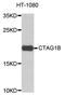 Cancer/Testis Antigen 1B antibody, A18294, Boster Biological Technology, Western Blot image 