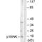 Cyclin Dependent Kinase Inhibitor 2C antibody, A03299, Boster Biological Technology, Western Blot image 