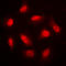 Protein Kinase AMP-Activated Non-Catalytic Subunit Beta 1 antibody, LS-C354056, Lifespan Biosciences, Immunofluorescence image 