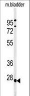 Tumor Protein P63 Regulated 1 Like antibody, LS-C160146, Lifespan Biosciences, Western Blot image 