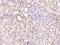 Succinate-CoA Ligase Alpha Subunit antibody, 201055-T10, Sino Biological, Immunohistochemistry paraffin image 