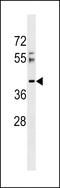 Arginine And Serine Rich Coiled-Coil 2 antibody, LS-C158903, Lifespan Biosciences, Western Blot image 