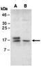 Ubiquitin-conjugating enzyme E2 B antibody, orb66911, Biorbyt, Western Blot image 