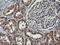 Mitogen-Activated Protein Kinase Kinase 1 antibody, LS-C174636, Lifespan Biosciences, Immunohistochemistry paraffin image 