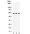Essential Meiotic Structure-Specific Endonuclease 1 antibody, R32300, NSJ Bioreagents, Western Blot image 