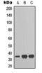RAD51 Paralog D antibody, LS-C368490, Lifespan Biosciences, Western Blot image 