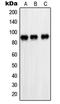 Poly(ADP-Ribose) Polymerase 1 antibody, LS-C351818, Lifespan Biosciences, Western Blot image 