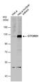 GTF2I Repeat Domain Containing 1 antibody, PA5-78295, Invitrogen Antibodies, Western Blot image 