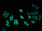 Tyrosine Kinase With Immunoglobulin Like And EGF Like Domains 1 antibody, LS-C671318, Lifespan Biosciences, Immunofluorescence image 