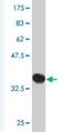 DAZ Interacting Zinc Finger Protein 3 antibody, H00009666-M01, Novus Biologicals, Western Blot image 