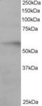 Interferon Regulatory Factor 6 antibody, TA302518, Origene, Western Blot image 