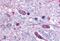 Solute Carrier Family 5 Member 3 antibody, NBP1-02399, Novus Biologicals, Immunohistochemistry paraffin image 