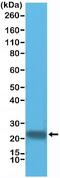 Glutathione S-Transferase Pi 1 antibody, NBP2-77420, Novus Biologicals, Western Blot image 