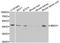 Gamma-Butyrobetaine Hydroxylase 1 antibody, STJ28373, St John