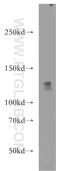 WD Repeat Domain 6 antibody, 20508-1-AP, Proteintech Group, Western Blot image 
